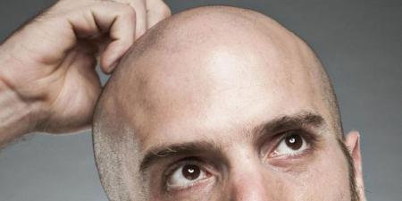 بشرى سارّة للصُلعان : عشبة عمرها ألف عام قد تكون الحل