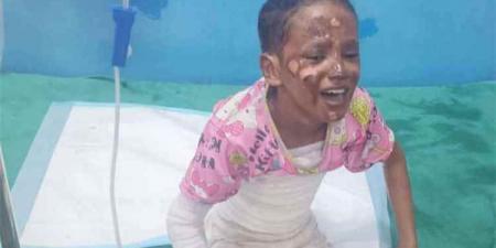 وفاة مؤلمة لطفلة أبين.. حريق يخطف فاطمة ويُبقي أشقاءها بين الحياة والموت