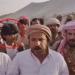 نقل نجل الشيخ حمد فدغم وحارسه الشخصي إلى العناية المركزة بمأرب إثر لدغة أفعى