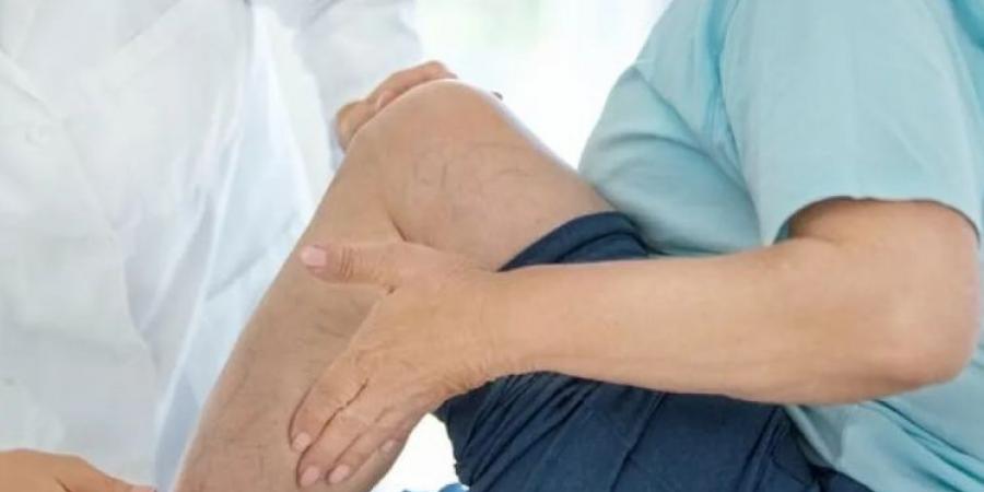 "عدوّة النساء اللدودة" .. ما هي دوالي الساقين ؟ وكيف تحدث ؟