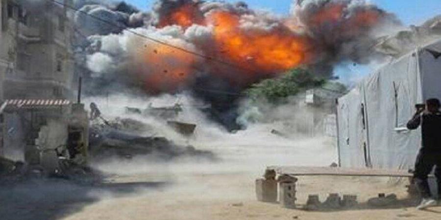 تحذيرات من كارثة صحية في غزة.. آلاف الإصابات بجدري الماء أسبوعياً ورصد حالات سل بين النازحين