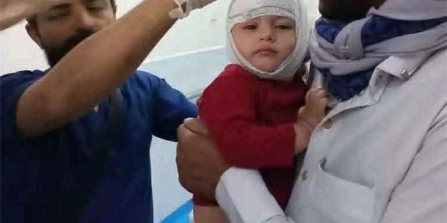 صادمة.. طفل يمني ينزف دماً بعد قصف حوثي على مخيم نازحين بمأرب